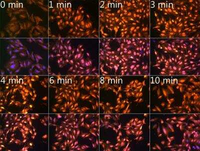 Immunocytochemistry/ Immunofluorescence: N6-methyladenosine (m6A) Antibody - Azide and BSA Free [NBP3-05657]