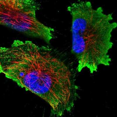 Immunocytochemistry/ Immunofluorescence: N6AMT2 Antibody [NBP2-30940]