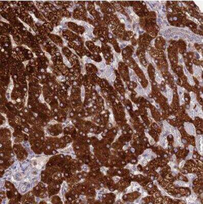 Immunohistochemistry-Paraffin: N6AMT2 Antibody [NBP2-30547]