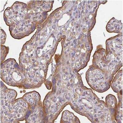 Immunohistochemistry: N6AMT2 Antibody [NBP2-30940]