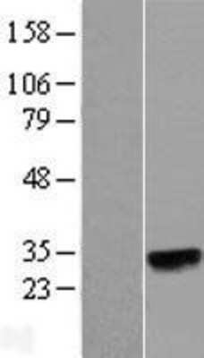 Western Blot: N6AMT2 Overexpression Lysate [NBL1-13451]