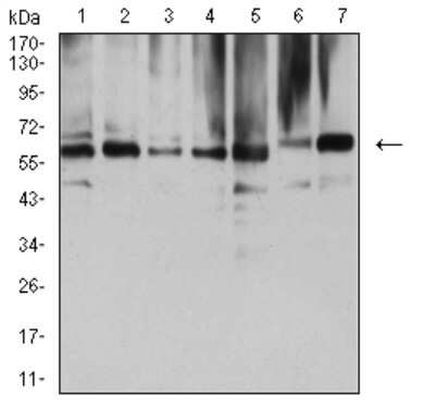 Western Blot: NAA10 Antibody (3G3B9)BSA Free [NBP2-61891]