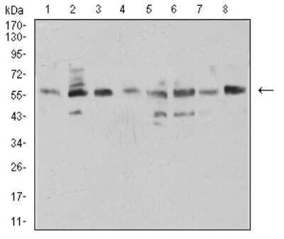 Western Blot: NAA10 Antibody (3G3E9)BSA Free [NBP2-61890]