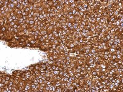 Immunohistochemistry-Paraffin: NAA10 Antibody [NBP2-19461]