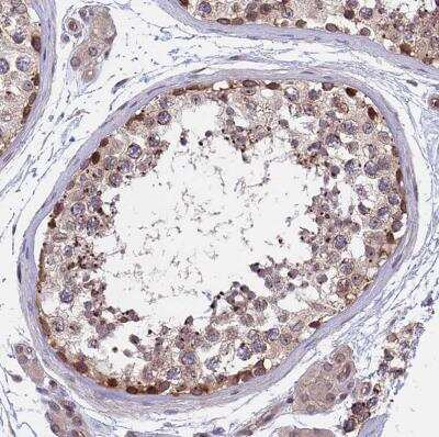Immunohistochemistry-Paraffin: NAA10 Antibody [NBP2-33934]
