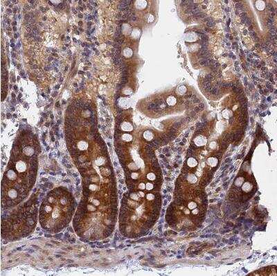 Immunohistochemistry-Paraffin: NAA10 Antibody [NBP2-33934]