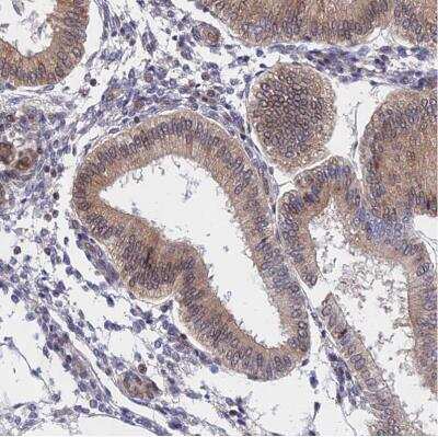 Immunohistochemistry-Paraffin: NAA10 Antibody [NBP2-33934]