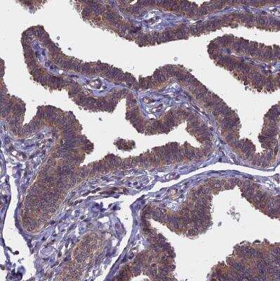 Immunohistochemistry-Paraffin: NAA10 Antibody [NBP2-33934]