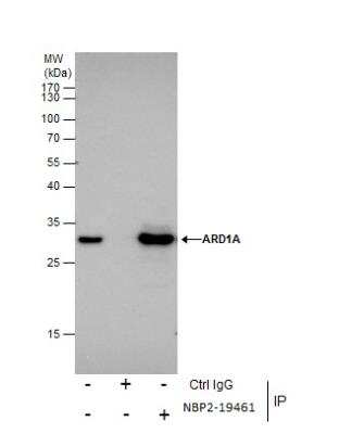 Immunoprecipitation: NAA10 Antibody [NBP2-19461]
