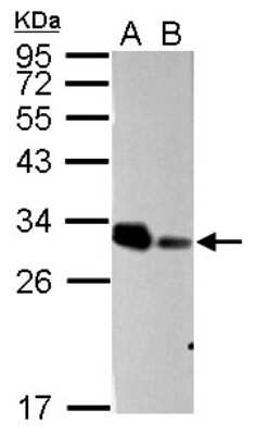 Western Blot: NAA10 Antibody [NBP2-19461]