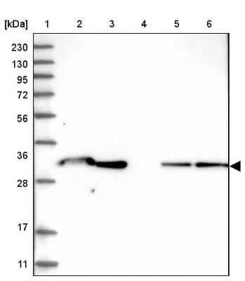 Western Blot: NAA10 Antibody [NBP2-33934]