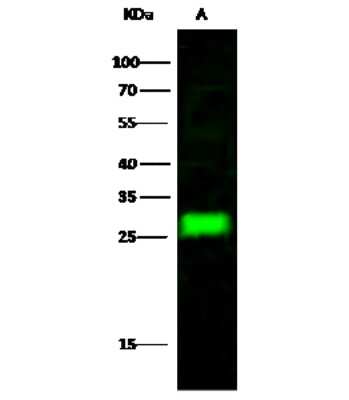 Western Blot: NAA10 Antibody [NBP3-00272]