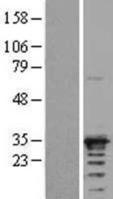 Western Blot: NAA10 Overexpression Lysate [NBL1-07647]