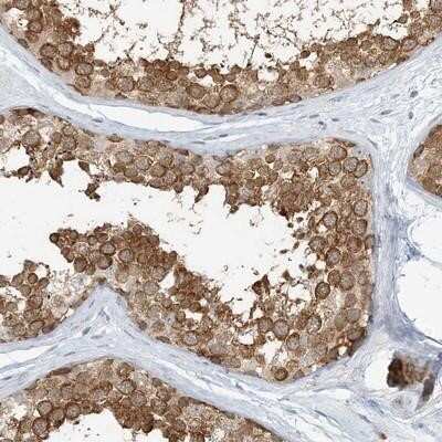 Immunohistochemistry-Paraffin: NAA11 Antibody [NBP1-90853]