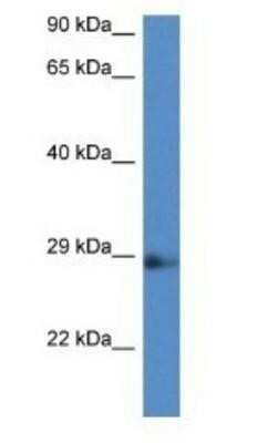 Western Blot: NAA11 Antibody [NBP1-91327]