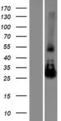 Western Blot: NAA11 Overexpression Lysate [NBP2-05980]