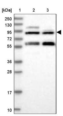 Western Blot: NAA25 Antibody [NBP1-88391]