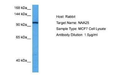 Western Blot: NAA25 Antibody [NBP2-83252]