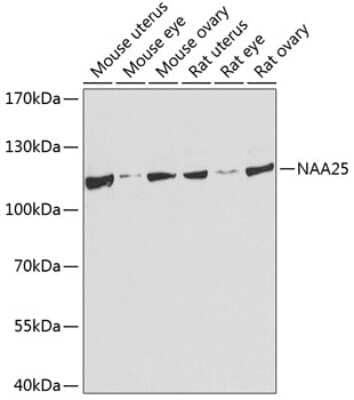 Western Blot: NAA25 AntibodyBSA Free [NBP2-94737]