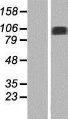 Western Blot: NAA25 Overexpression Lysate [NBP2-06253]