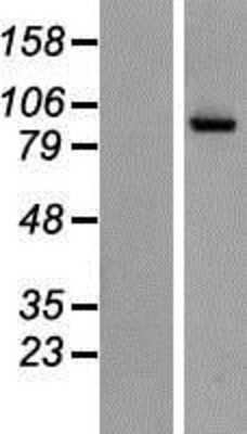 Western Blot: NAALADase-2/NAALAD2 Overexpression Lysate [NBP2-07747]