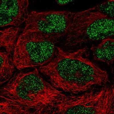 Immunocytochemistry/ Immunofluorescence: NAALADase-2/NAALAD2 Antibody [NBP2-56951]