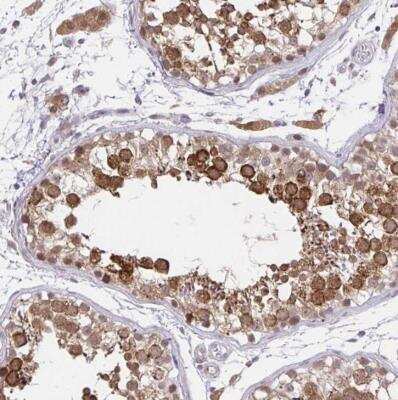 Immunohistochemistry-Paraffin: NAALADase-2/NAALAD2 Antibody [NBP2-31840]