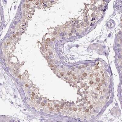 Immunohistochemistry-Paraffin: NAALADase-2/NAALAD2 Antibody [NBP2-56951]