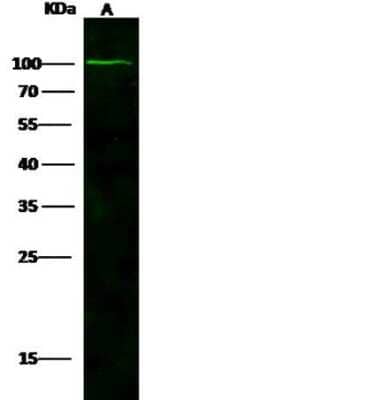 Western Blot: NAALADase-like 1/NAALADL1 Antibody (29) [NBP2-89819]