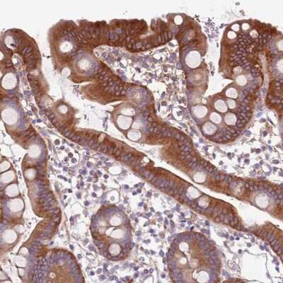 Immunohistochemistry-Paraffin: NAALADase-like 1/NAALADL1 Antibody [NBP2-14584]