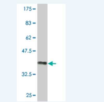 Western Blot: NAALADase-like 2/NAALADL2 Antibody (1G5) [H00254827-M02]