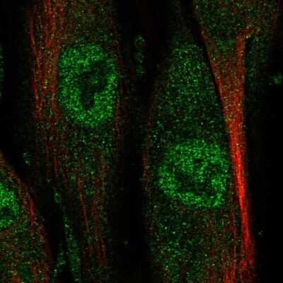 Immunocytochemistry/ Immunofluorescence: NAALADase-like 2/NAALADL2 Antibody [NBP1-86445]