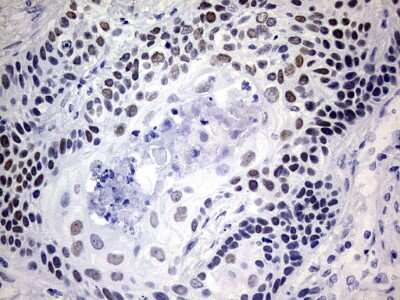 Immunohistochemistry: NAB1 Antibody (OTI1D2) [NBP2-46079]