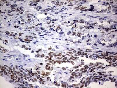 Immunohistochemistry: NAB1 Antibody (OTI1D2) [NBP2-46079]