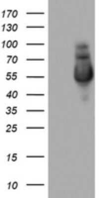 Western Blot: NAB1 Antibody (OTI1D2) [NBP2-46079]