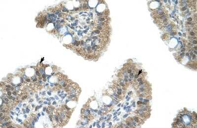 Immunohistochemistry: NAB1 Antibody [NBP2-87876]