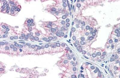 Immunohistochemistry: NAB1 Antibody [NBP2-87876]