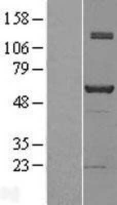 Western Blot: NAB1 Overexpression Lysate [NBL1-13452]