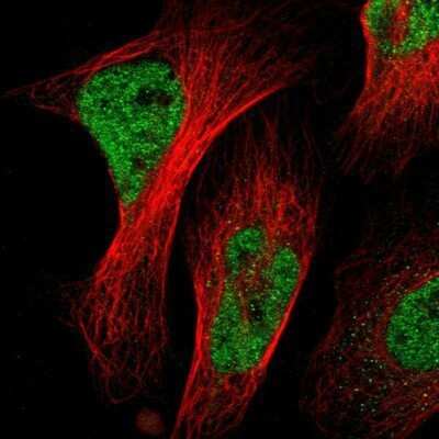 Immunocytochemistry/ Immunofluorescence: NAC1 Antibody [NBP1-89991]