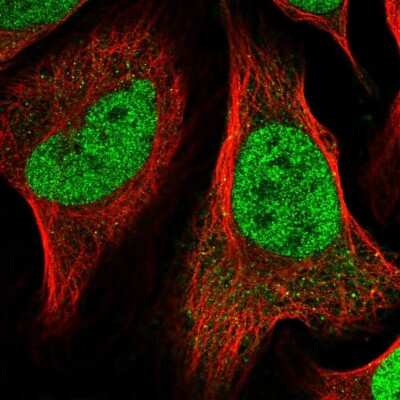 Immunocytochemistry/ Immunofluorescence: NAC1 Antibody [NBP2-49361]