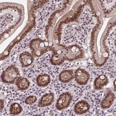 Immunohistochemistry-Paraffin: NAC1 Antibody [NBP2-49361]