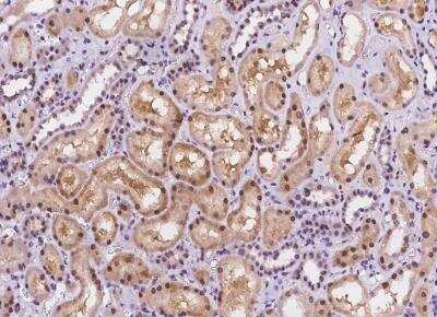 Immunohistochemistry-Paraffin: NAC1 Antibody [NBP2-97154]
