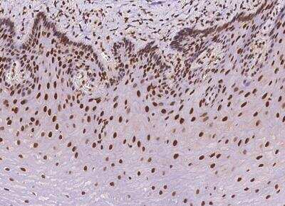 Immunohistochemistry-Paraffin: NAC1 Antibody [NBP2-97154]