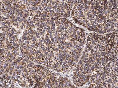 Immunohistochemistry-Paraffin: NAC1 Antibody [NBP2-98710]