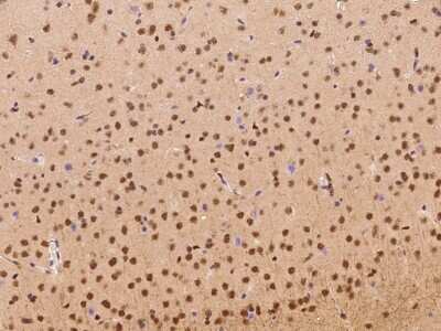 Immunohistochemistry-Paraffin: NAC1 Antibody [NBP2-99428]