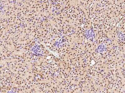 Immunohistochemistry-Paraffin: NAC1 Antibody [NBP2-99428]