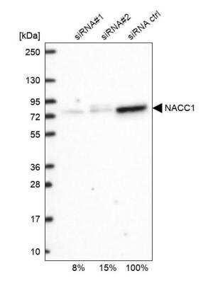 Western Blot: NAC1 Antibody [NBP2-49361]