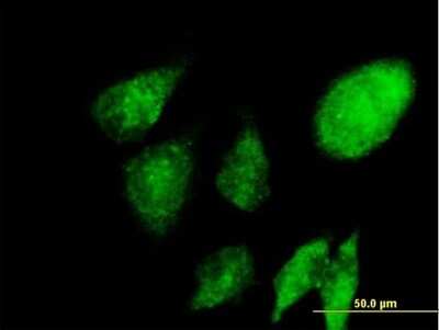 Immunocytochemistry/ Immunofluorescence: NACA1 Antibody [H00004666-B01P]