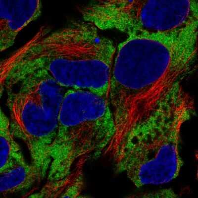 Immunocytochemistry/ Immunofluorescence: NACA1 Antibody [NBP2-57786]