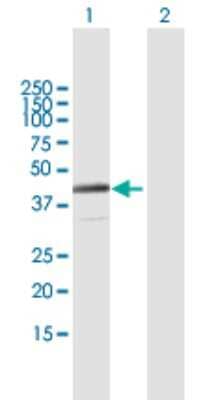 Western Blot: NACA2 Antibody [H00342538-B01P]